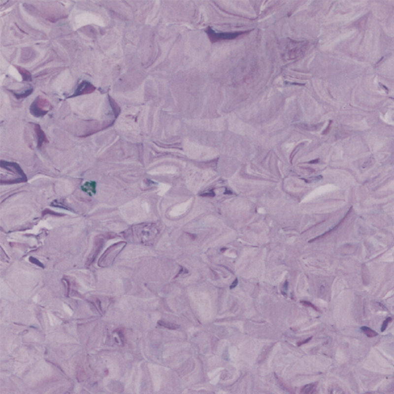 perfectbalance homogenea tabulata