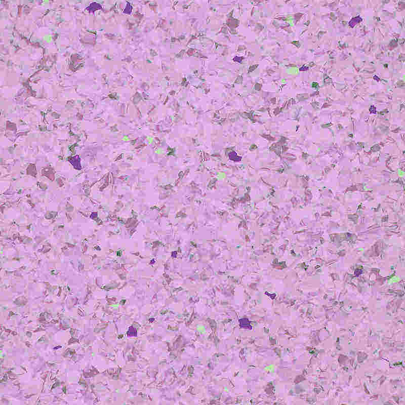 Mollis et mulcens homogenea tabulata